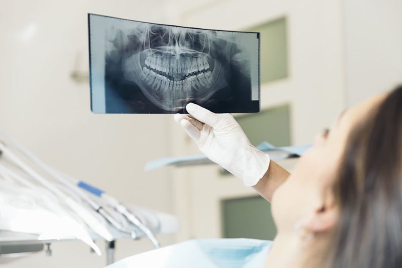Chụp X-Quang và điều trị tổng quát trước khi niềng răng